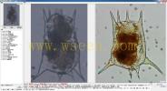 Brachionus calyciflorus 萼花臂尾轮虫--万深AlgaeC_002